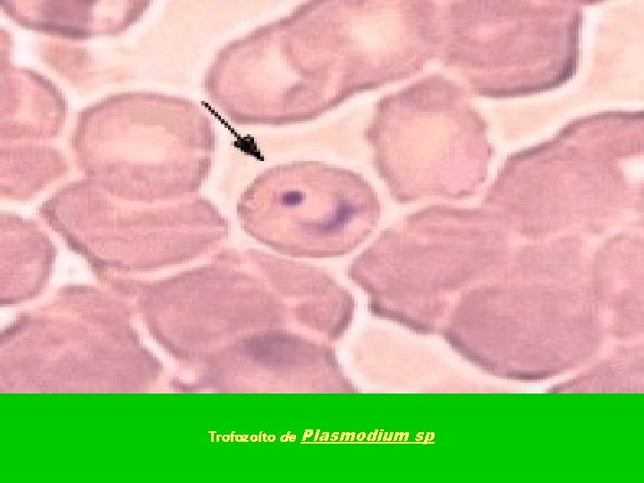 Trofozoíto de Plasmodium sp 