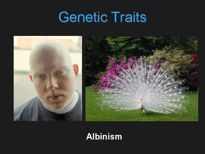 Genetic Traits Albinism 