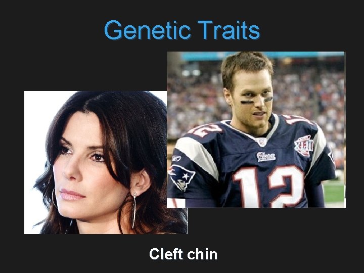 Genetic Traits Cleft chin 