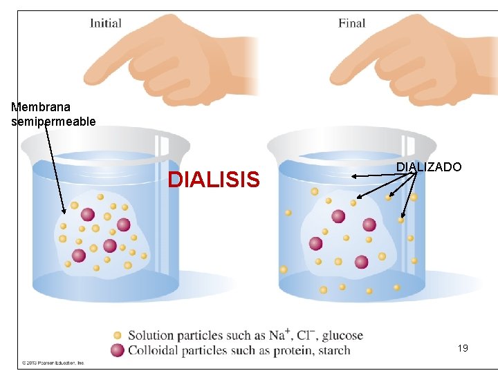 Membrana semipermeable DIALISIS DIALIZADO 19 