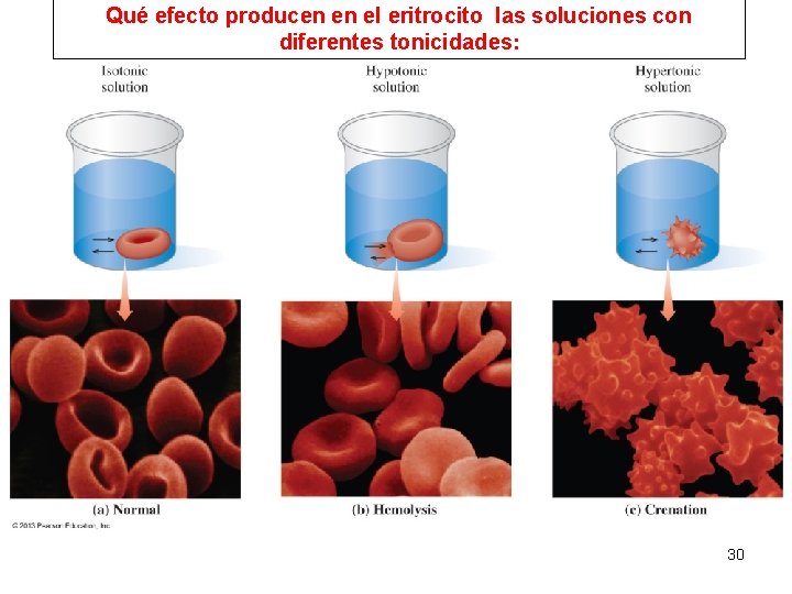 Qué efecto producen en el eritrocito las soluciones con diferentes tonicidades: 30 