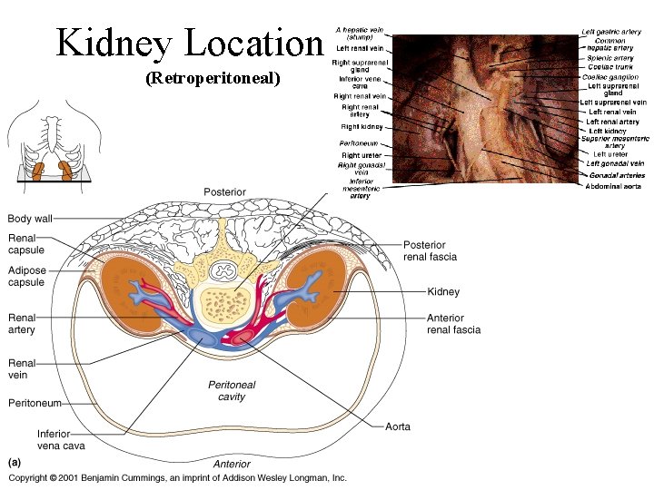 Kidney Location (x. s. ) (Retroperitoneal) 