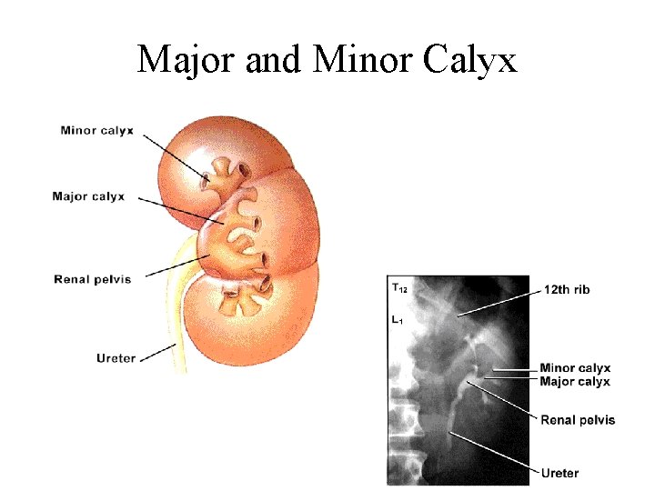 Major and Minor Calyx 