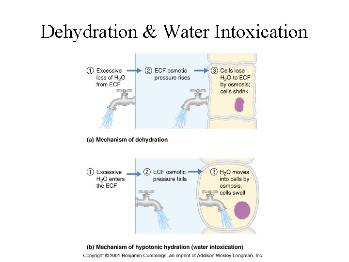 Dehydration & Water Intoxication 