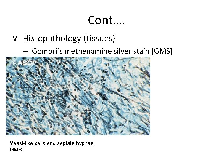Cont…. v Histopathology (tissues) – Gomori’s methenamine silver stain [GMS] Yeast-like cells and septate
