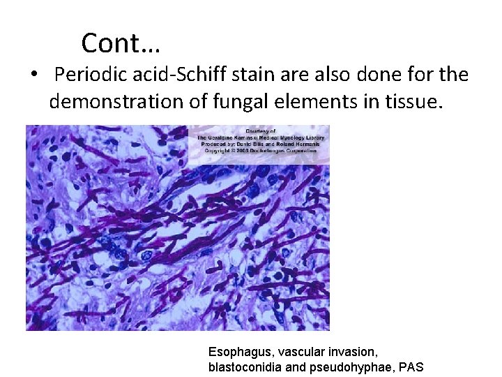 Cont… • Periodic acid-Schiff stain are also done for the demonstration of fungal elements