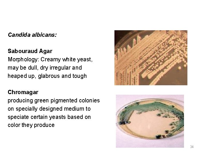 Candida albicans: Sabouraud Agar Morphology: Creamy white yeast, may be dull, dry irregular and