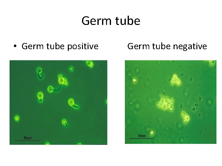 Germ tube • Germ tube positive Germ tube negative 