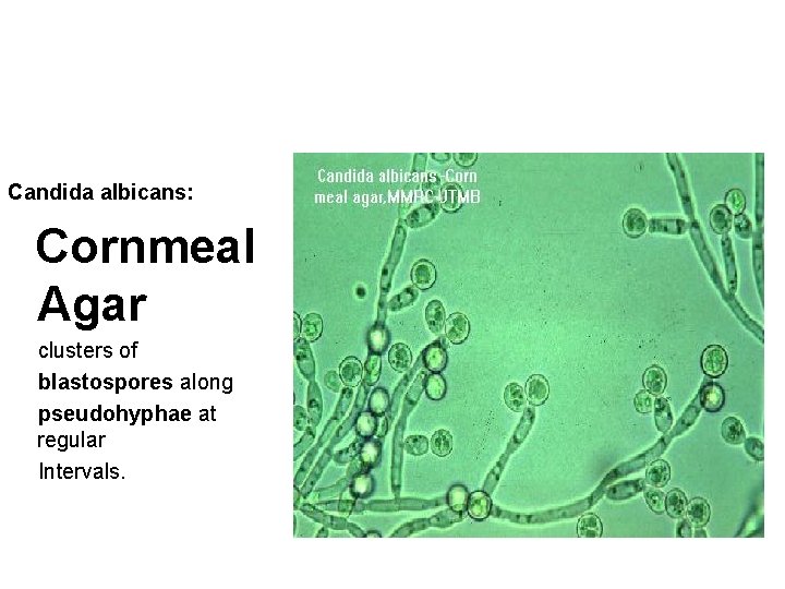 Candida albicans: Cornmeal Agar clusters of blastospores along pseudohyphae at regular Intervals. 