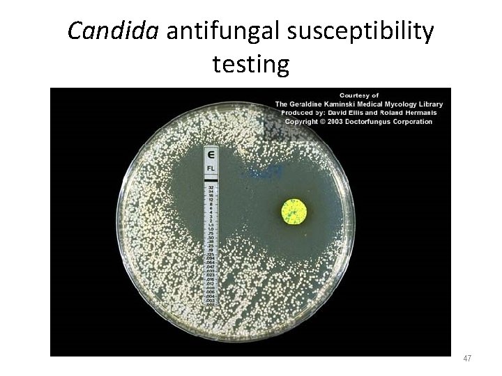 Candida antifungal susceptibility testing 47 