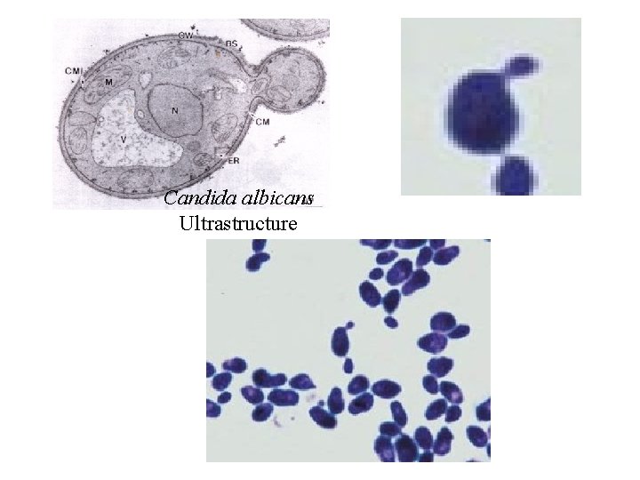 Candida albicans Ultrastructure 