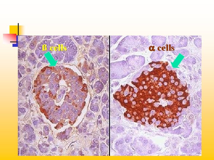 ß cells a cells 