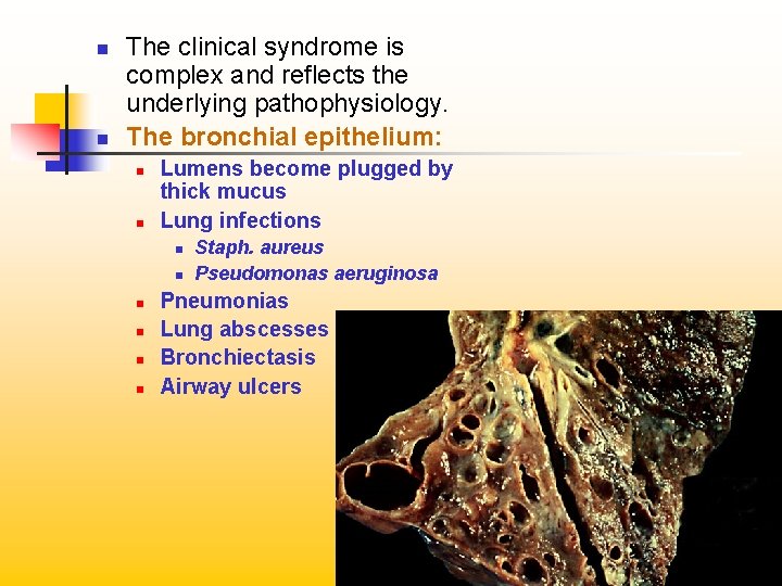 n n The clinical syndrome is complex and reflects the underlying pathophysiology. The bronchial