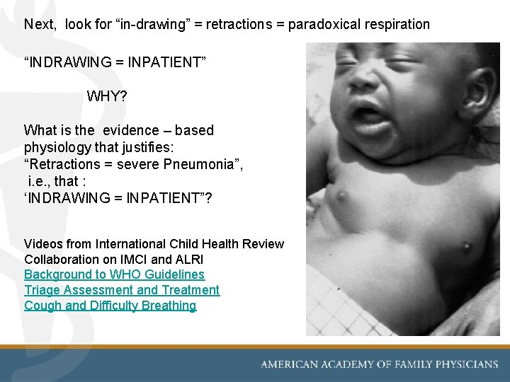 Next, look for “in-drawing” = retractions = paradoxical respiration “INDRAWING = INPATIENT” WHY? What