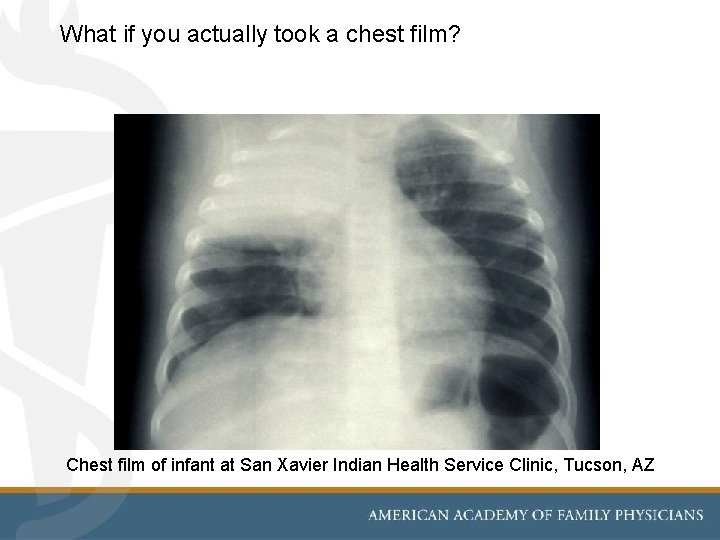 What if you actually took a chest film? Chest film of infant at San