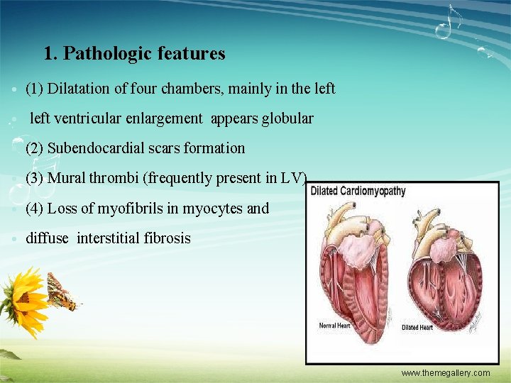 1. Pathologic features • (1) Dilatation of four chambers, mainly in the left •
