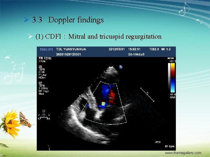 Ø 3. 3 Doppler findings Ø (1) CDFI：Mitral and tricuspid regurgitation www. themegallery. com