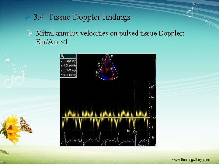 Ø 3. 4 Tissue Doppler findings Ø Mitral annulus velocities on pulsed tissue Doppler: