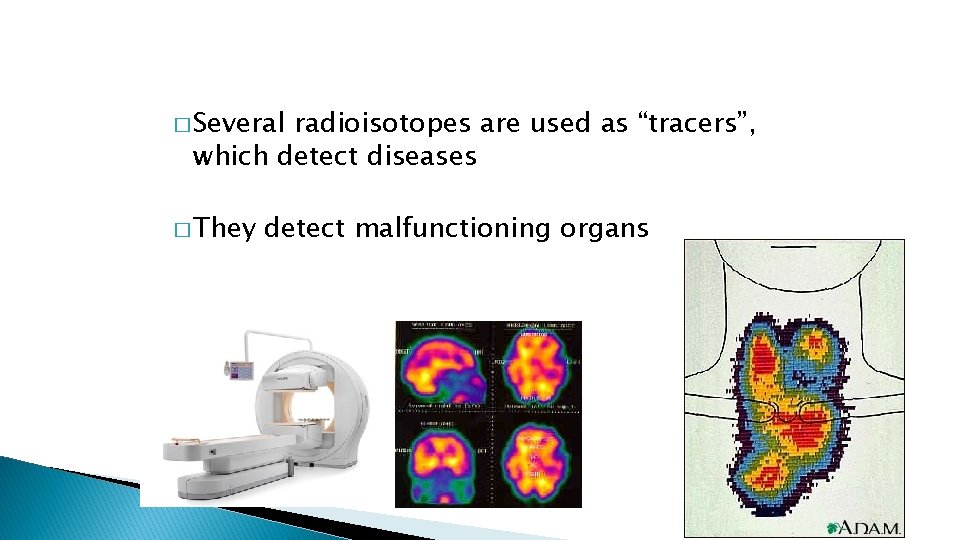 � Several radioisotopes are used as “tracers”, which detect diseases � They detect malfunctioning � Several radioisotopes are used as “tracers”, which detect diseases � They detect malfunctioning