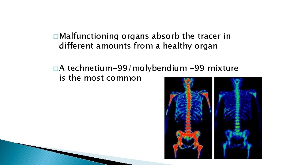 � Malfunctioning organs absorb the tracer in different amounts from a healthy organ �A � Malfunctioning organs absorb the tracer in different amounts from a healthy organ �A