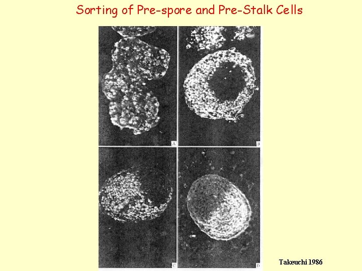 Sorting of Pre-spore and Pre-Stalk Cells Takeuchi 1986 