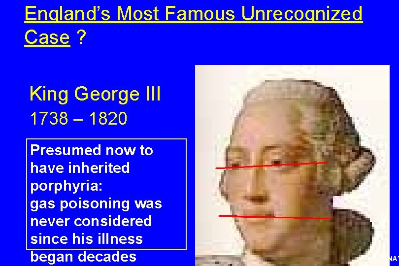 England’s Most Famous Unrecognized Case ? King George III 1738 – 1820 Presumed now