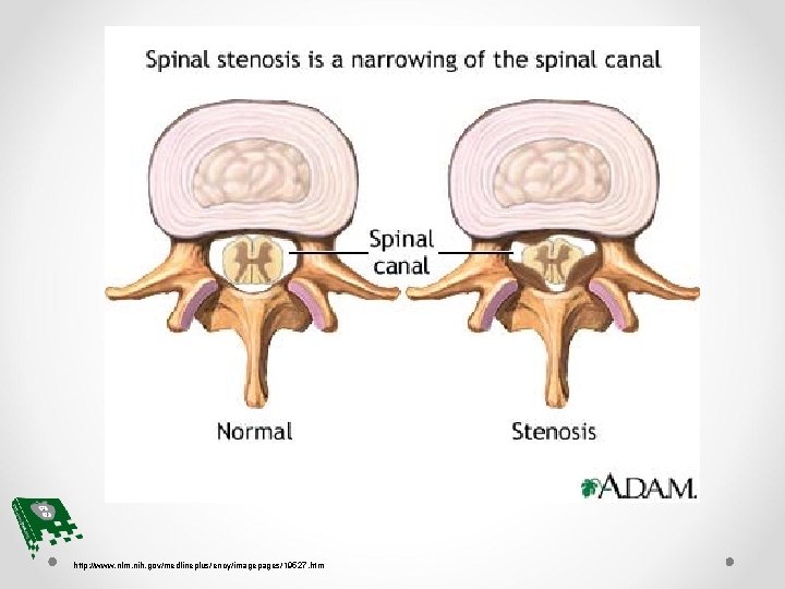 http: //www. nlm. nih. gov/medlineplus/ency/imagepages/19527. htm 