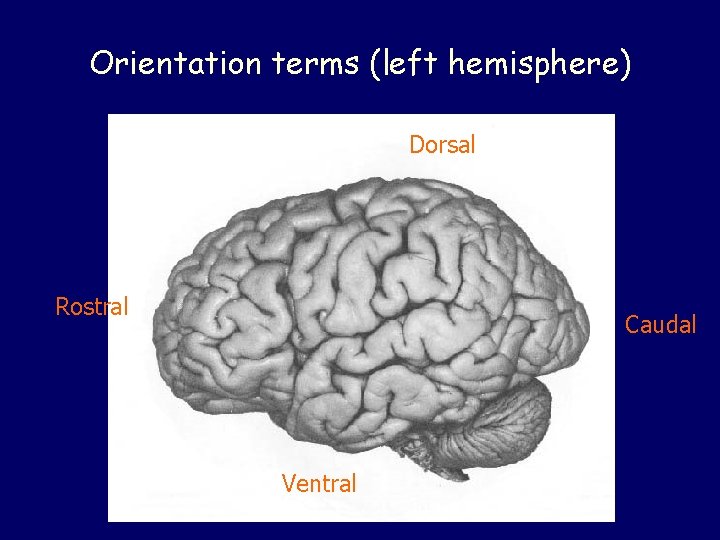 Orientation terms (left hemisphere) Dorsal Rostral Caudal Ventral Orientation terms (left hemisphere) Dorsal Rostral Caudal Ventral