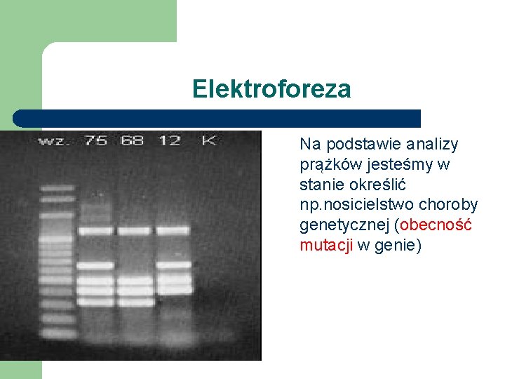 Elektroforeza Na podstawie analizy prążków jesteśmy w stanie określić np. nosicielstwo choroby genetycznej (obecność