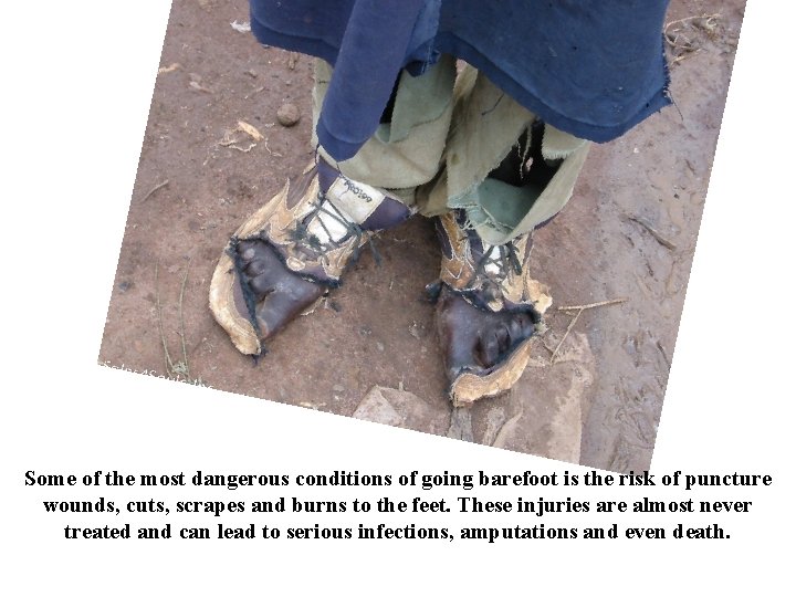 Some of the most dangerous conditions of going barefoot is the risk of puncture
