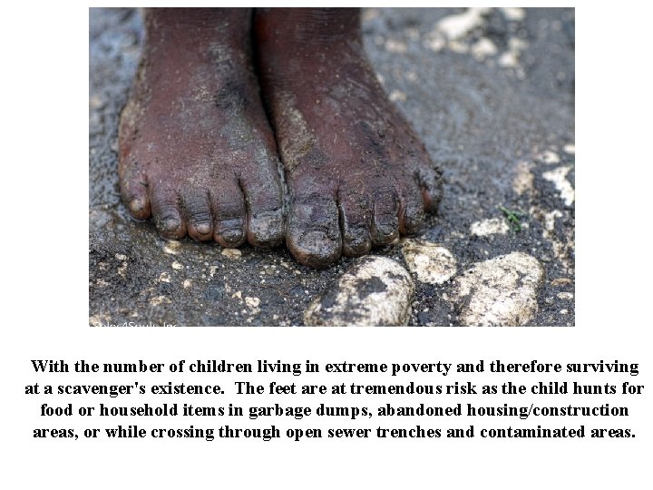 With the number of children living in extreme poverty and therefore surviving at a