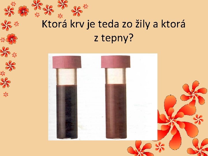 Ktorá krv je teda zo žily a ktorá z tepny? 