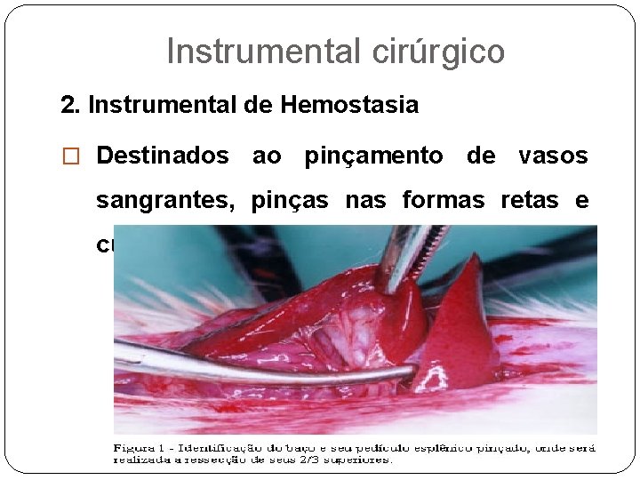 Instrumental cirúrgico 2. Instrumental de Hemostasia � Destinados ao pinçamento de vasos sangrantes, pinças