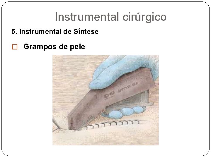 Instrumental cirúrgico 5. Instrumental de Síntese � Grampos de pele 