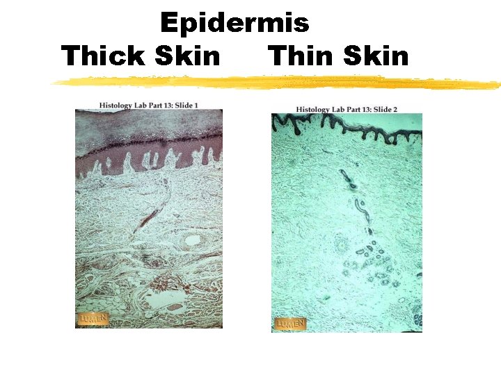 Epidermis Thick Skin Thin Skin 