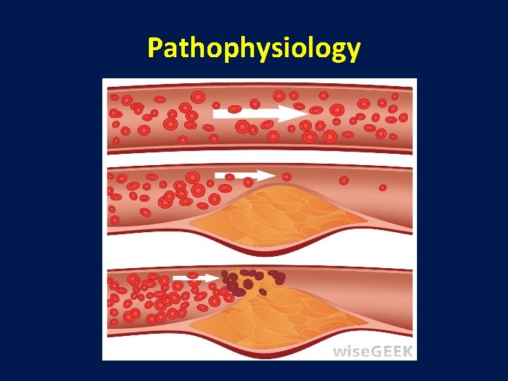 Pathophysiology 