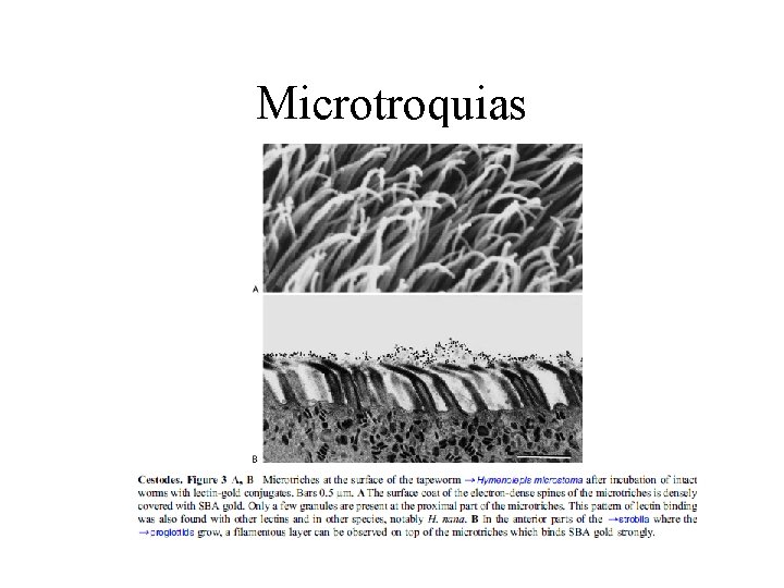 Microtroquias 