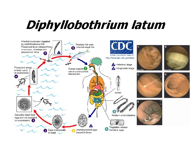 Diphyllobothrium latum 