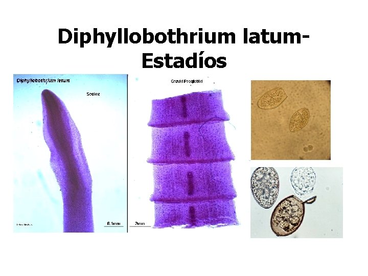 Diphyllobothrium latum. Estadíos 