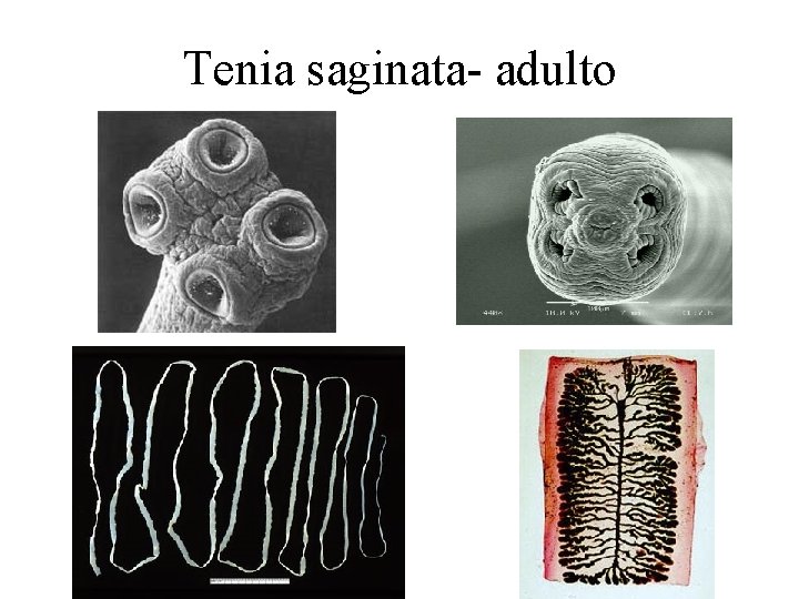 Tenia saginata- adulto 