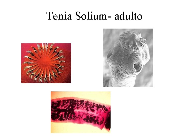 Tenia Solium- adulto 