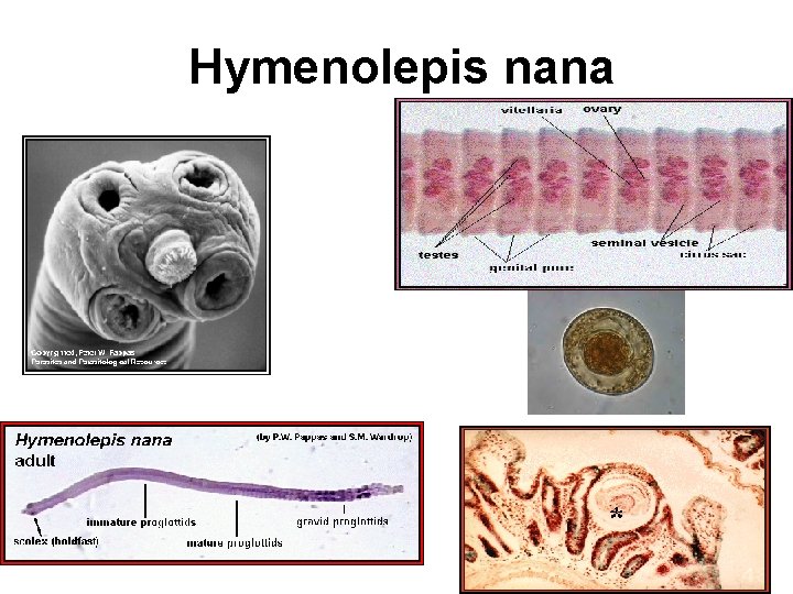 Hymenolepis nana 