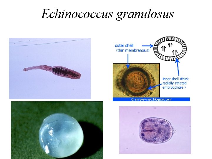 Echinococcus granulosus 