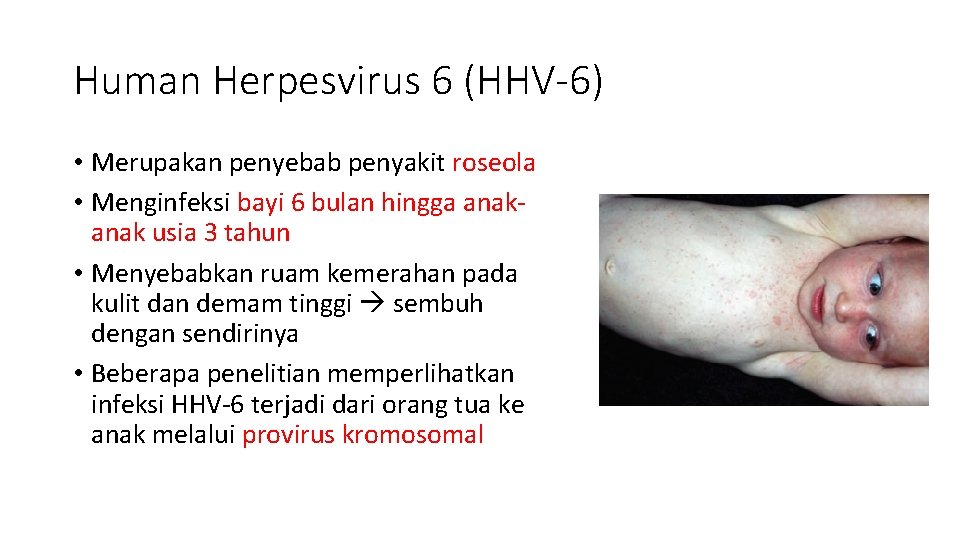 Human Herpesvirus 6 (HHV-6) • Merupakan penyebab penyakit roseola • Menginfeksi bayi 6 bulan