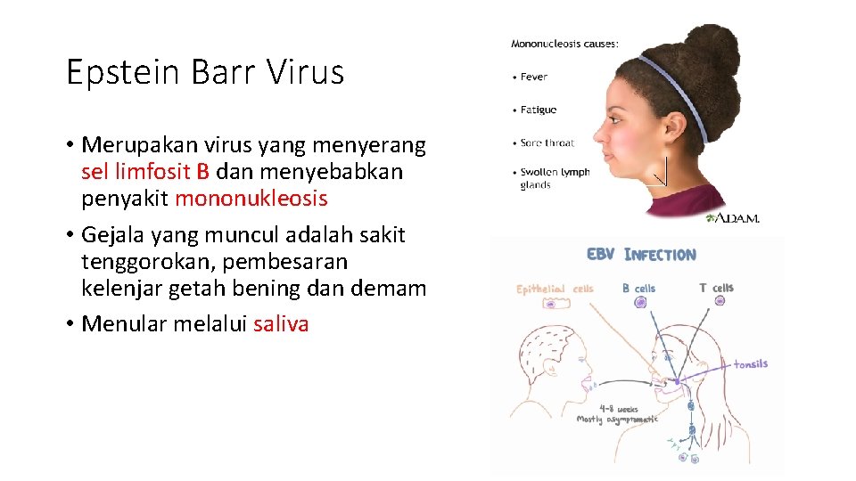 Epstein Barr Virus • Merupakan virus yang menyerang sel limfosit B dan menyebabkan penyakit