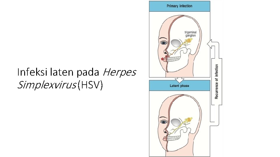 Infeksi laten pada Herpes Simplexvirus (HSV) 