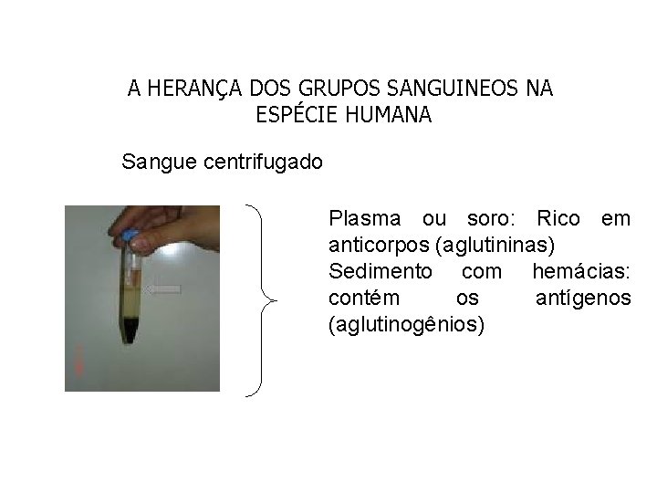 A HERANÇA DOS GRUPOS SANGUINEOS NA ESPÉCIE HUMANA Sangue centrifugado Plasma ou soro: Rico