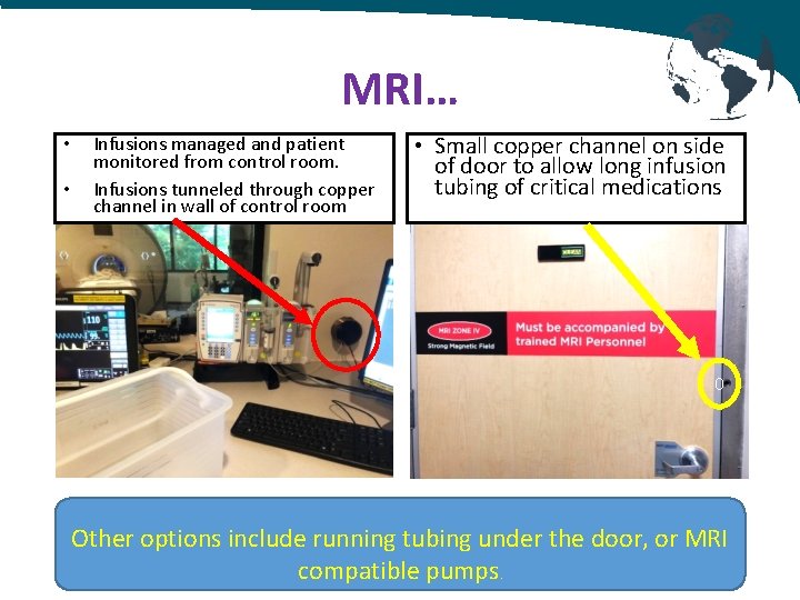 MRI… • • Infusions managed and patient monitored from control room. Infusions tunneled through MRI… • • Infusions managed and patient monitored from control room. Infusions tunneled through