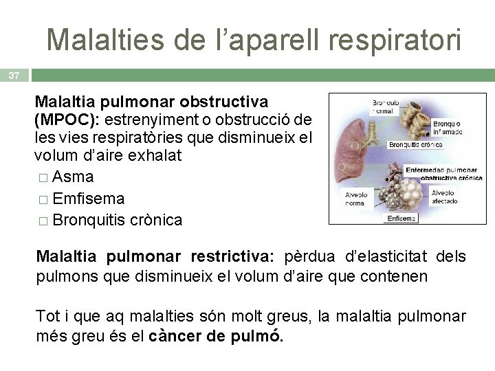 Malalties de l’aparell respiratori 37 Malaltia pulmonar obstructiva (MPOC): estrenyiment o obstrucció de les