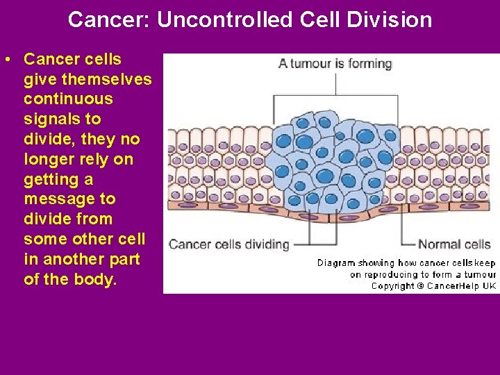 Cancer: Uncontrolled Cell Division • Cancer cells give themselves continuous signals to divide, they